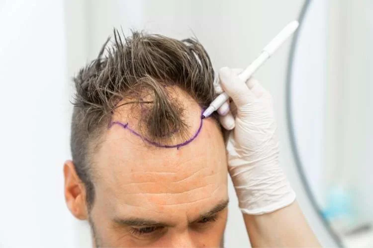 DHI Hair Transplant and Restoration Clinic  Jaipur Hair Transplant Clinic  in Jaipur Jaipur  Book Appointment View Fees Feedbacks  Practo