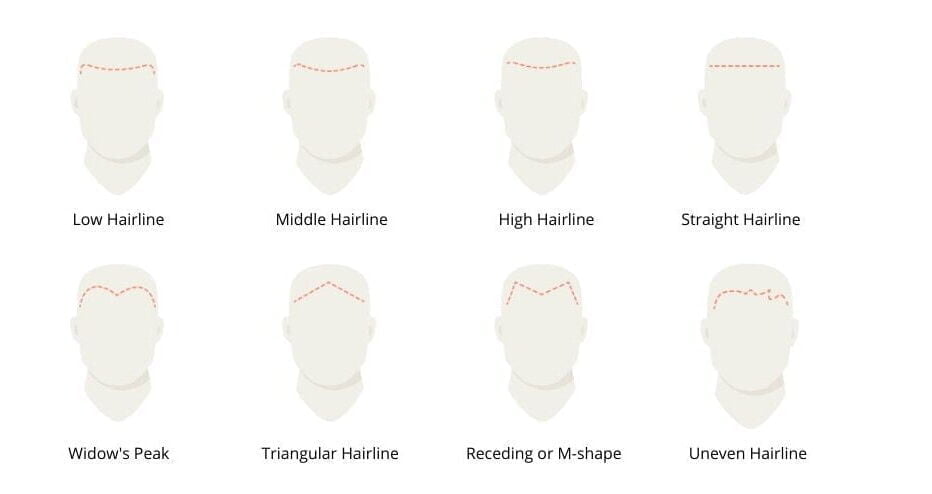 Hairlines Types