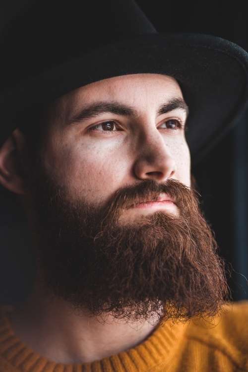 زراعة اللحية 2 beard transplant 1